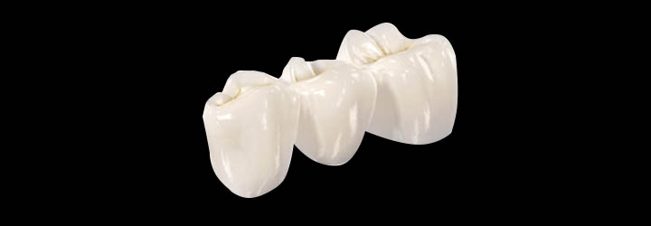 οδοντοτεχνικό εργαστήριο Λωρεντης layered zirconia crown-bridges