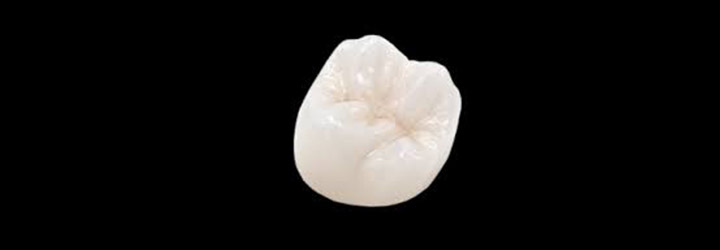 οδοντοτεχνικό εργαστήριο Λωρεντης full contour zirconia crown-bridges