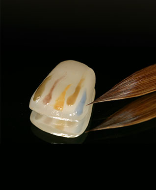 dental crown bridges uk